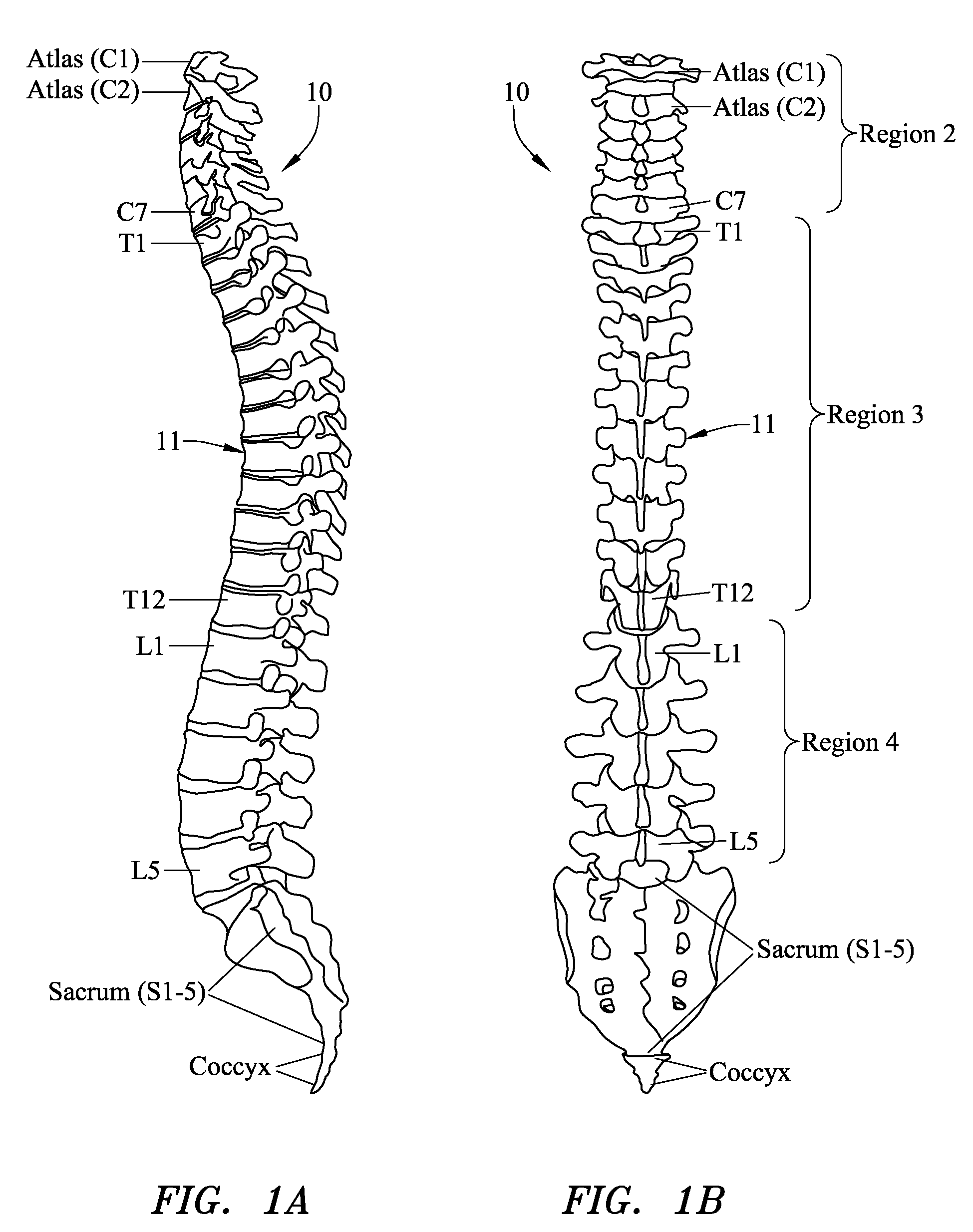 Systems, methods and devices for correcting spinal deformities