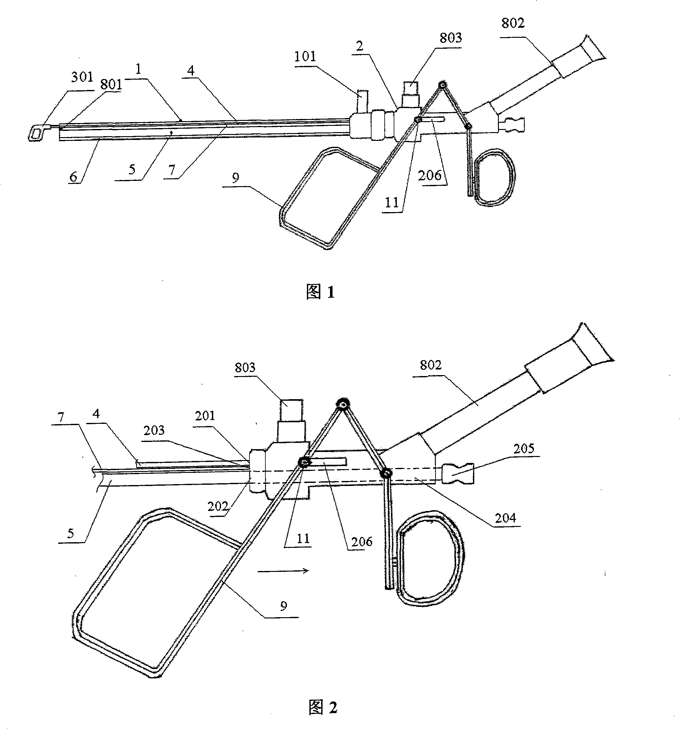 Bladder renal pelvis stones extraction lens