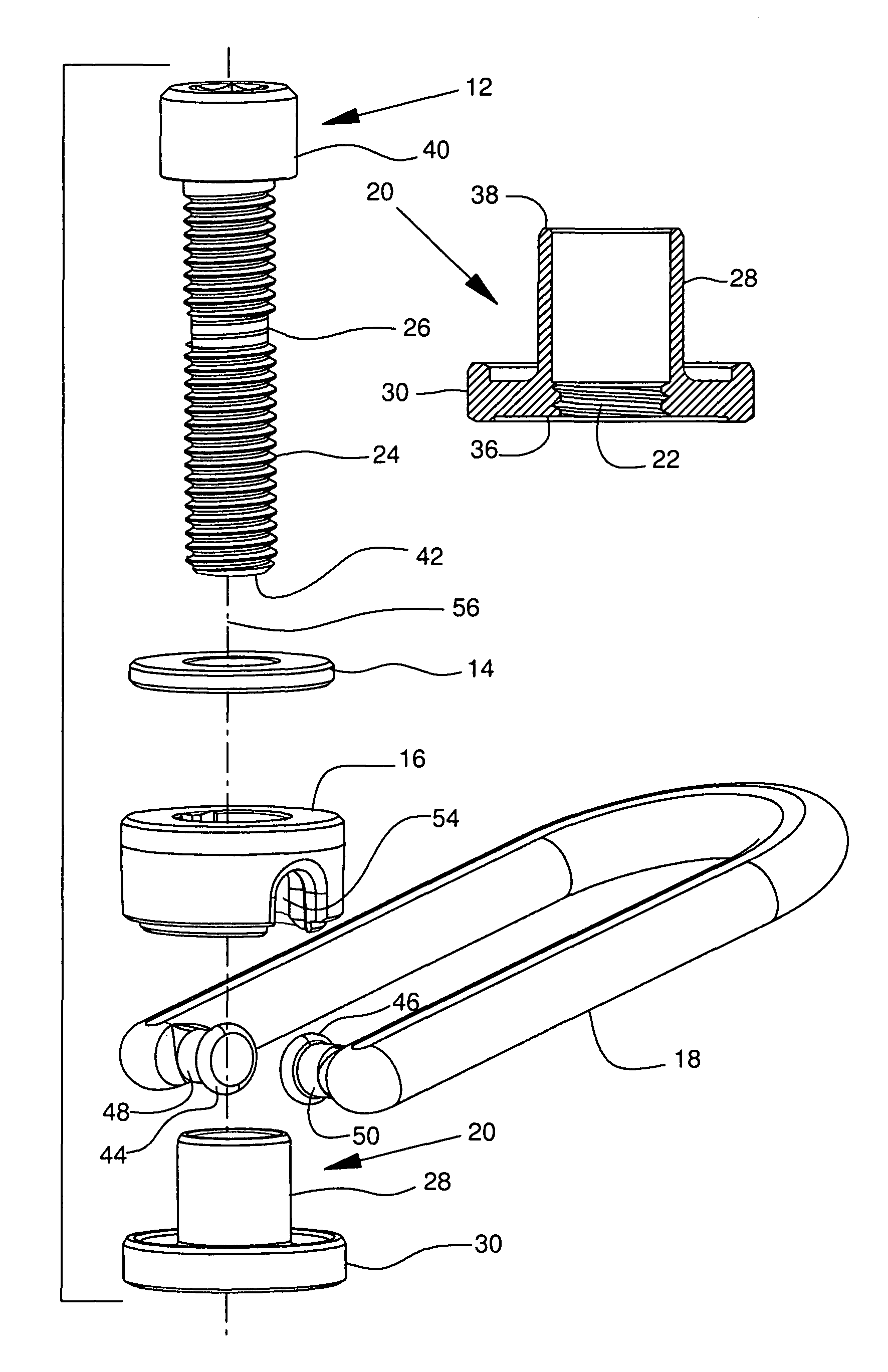 Threaded hoist ring screw retainer