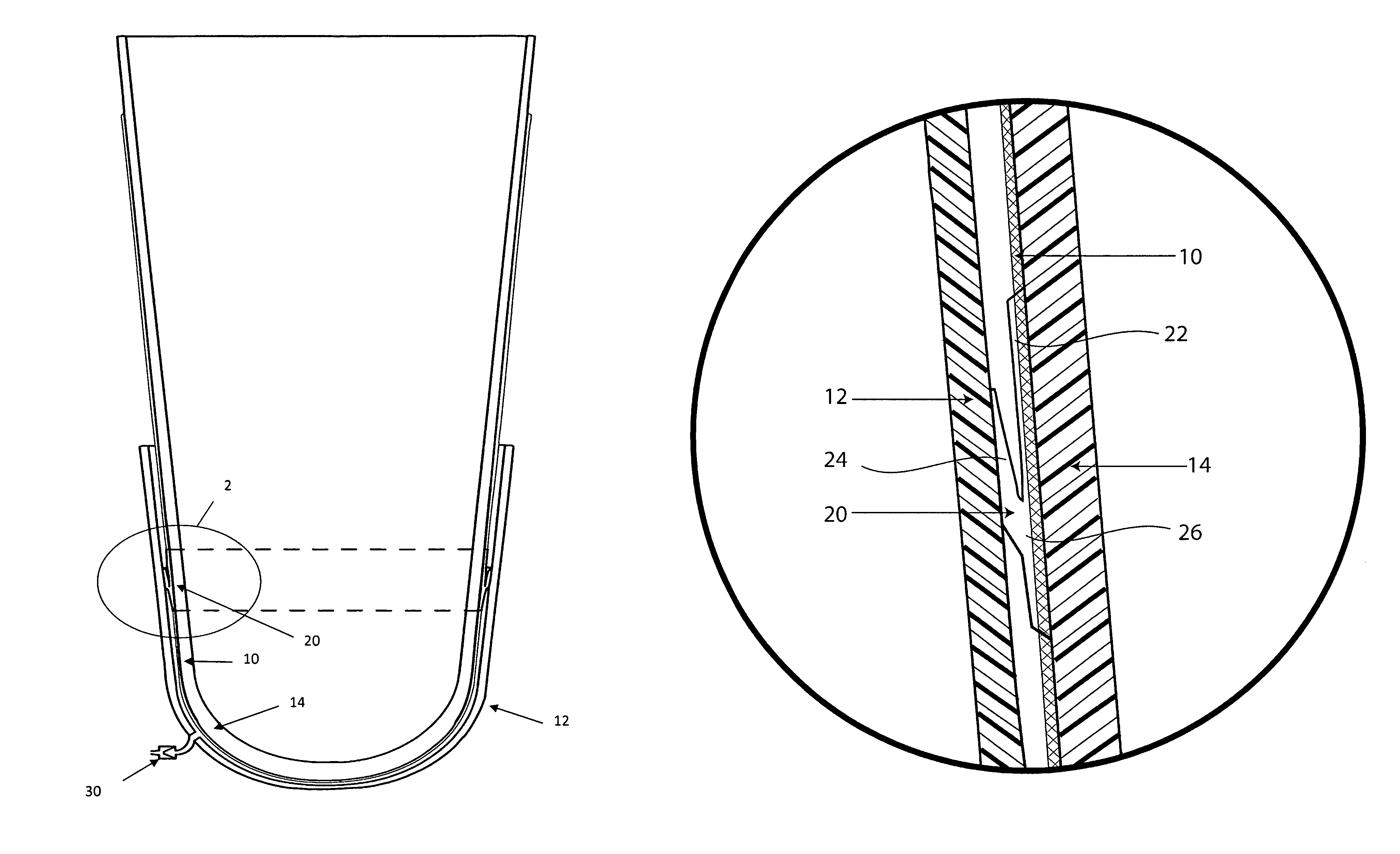 Sealing sheath for prosthetic liner and related methods