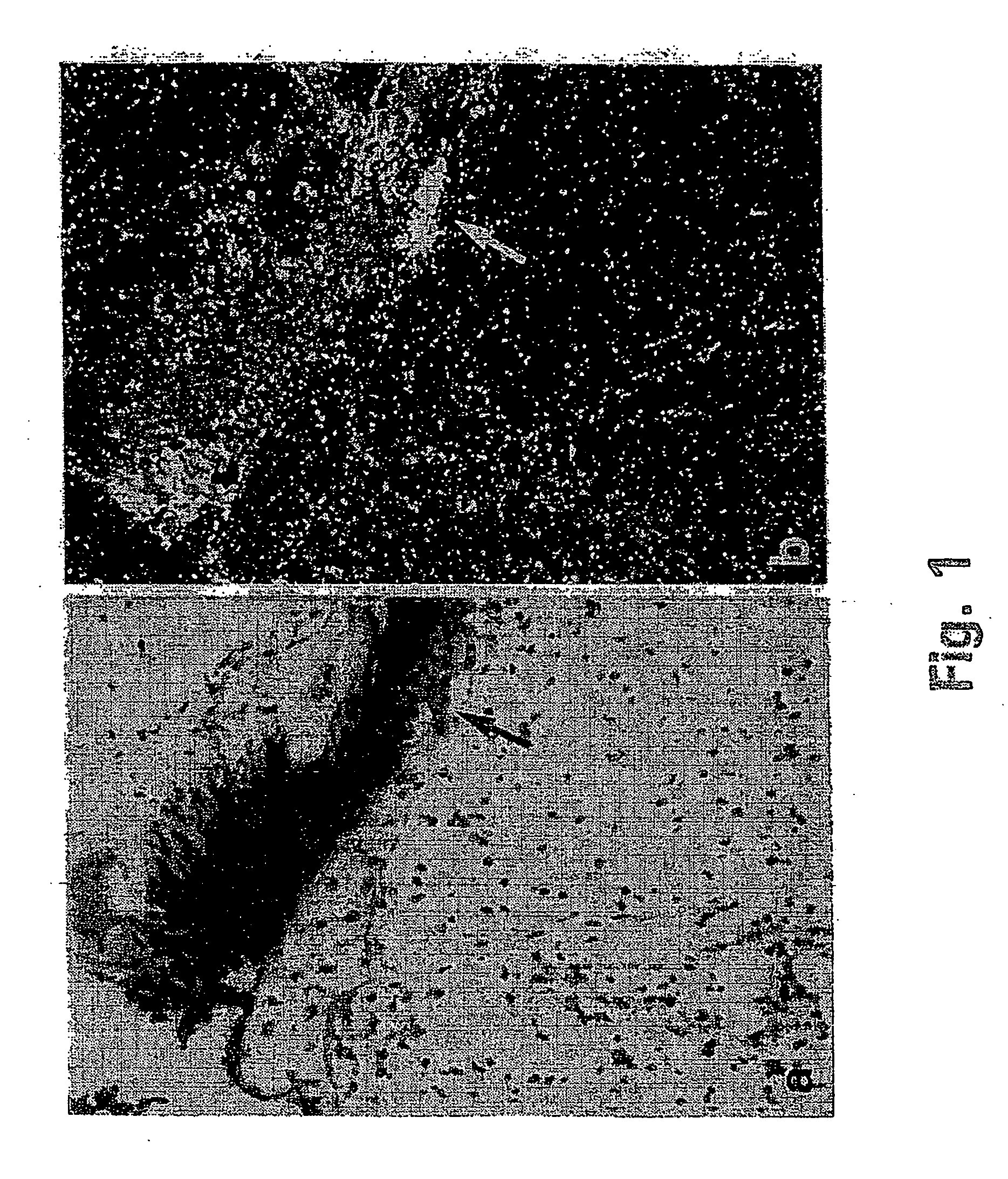 Inhibition of invasive remodelling