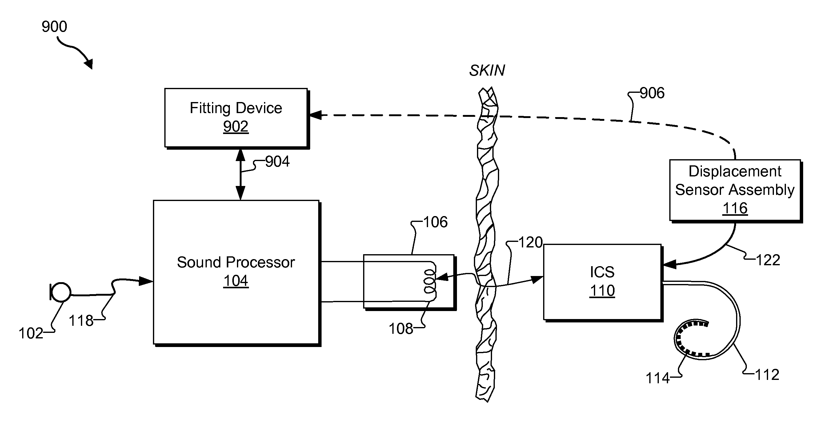 Systems and Methods for Fitting a Cochlear Implant System to a Patient Based on Stapedius Displacement