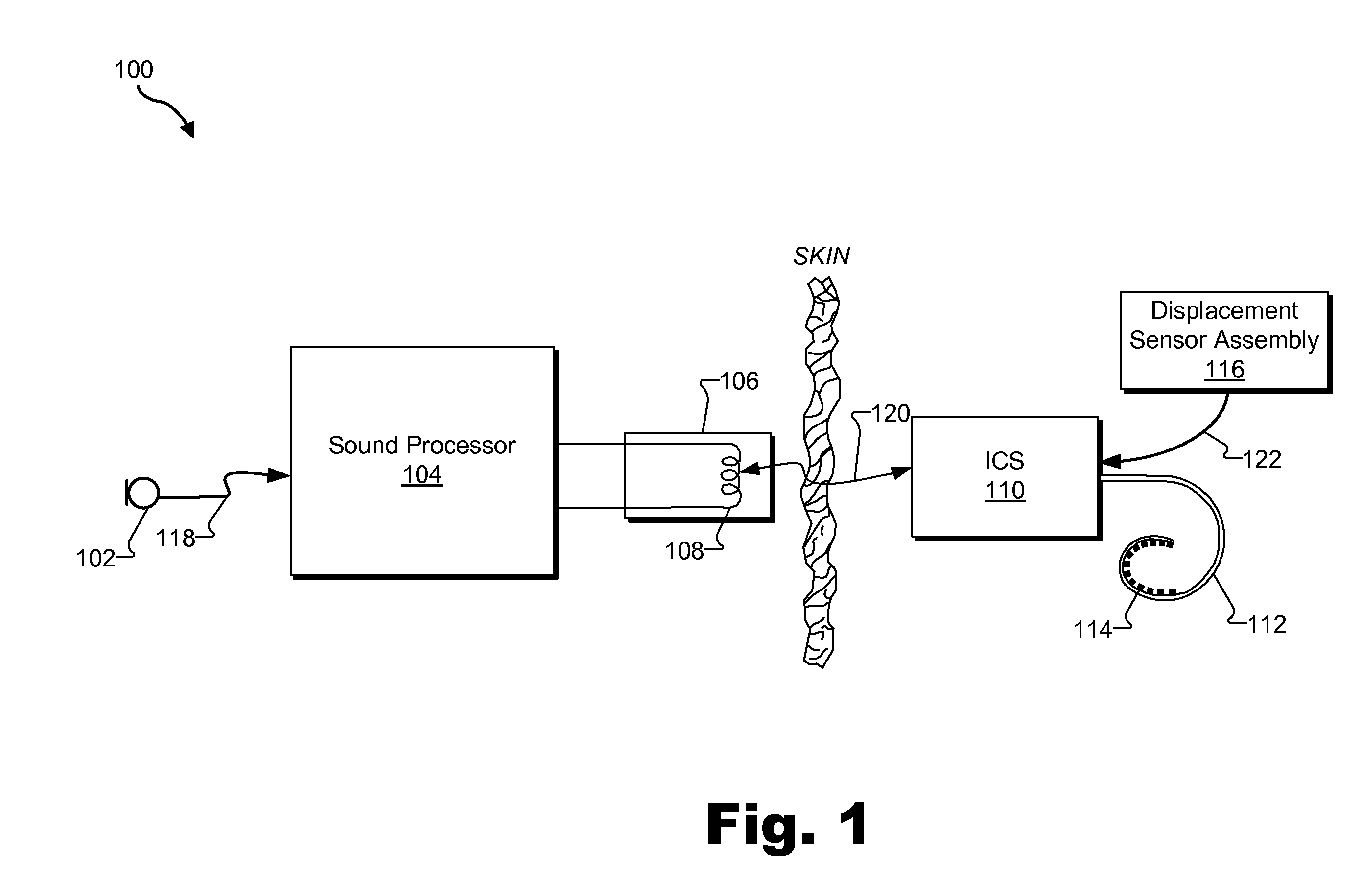 Systems and Methods for Fitting a Cochlear Implant System to a Patient Based on Stapedius Displacement