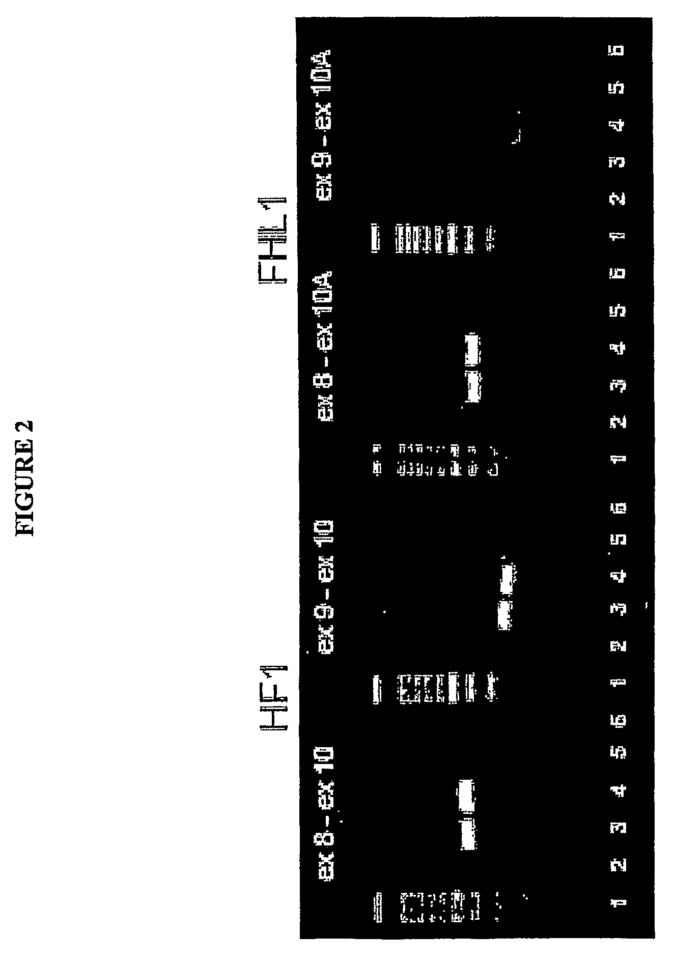 Methods and reagents for treatment and diagnosis of age-related macular degeneration