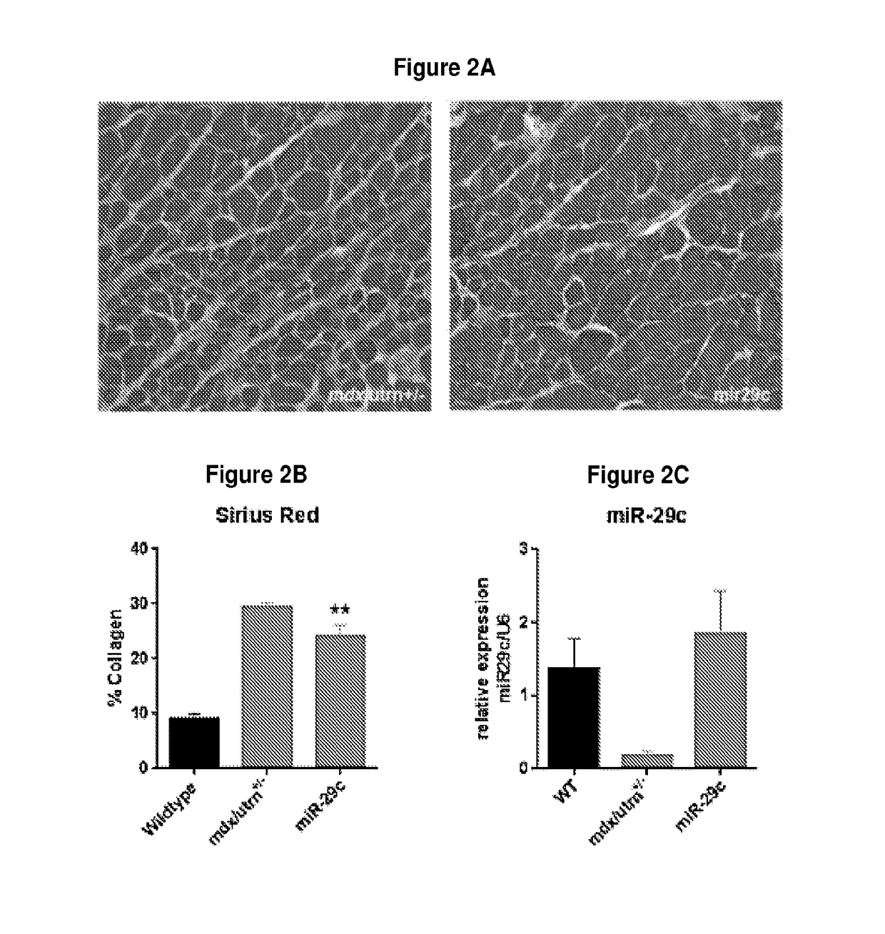 Adeno-associated virus vector delivery of microrna-29 and micro-dystrophin to treat muscular dystrophy