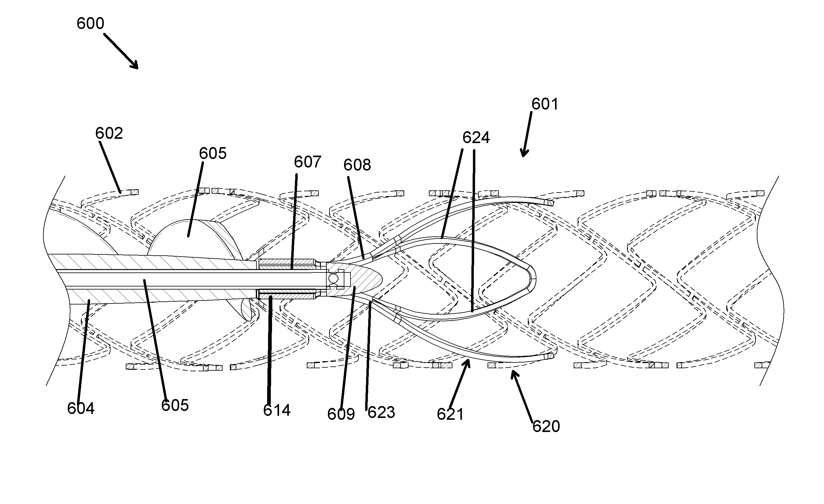 Distal bearing support