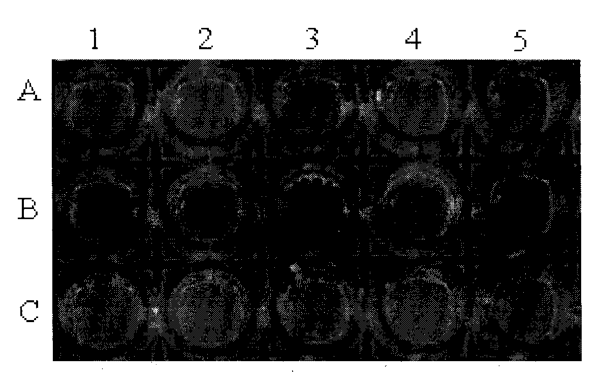 Pseudomonas aeruginosa capable of secreting fluorescent iron carrier and application thereof