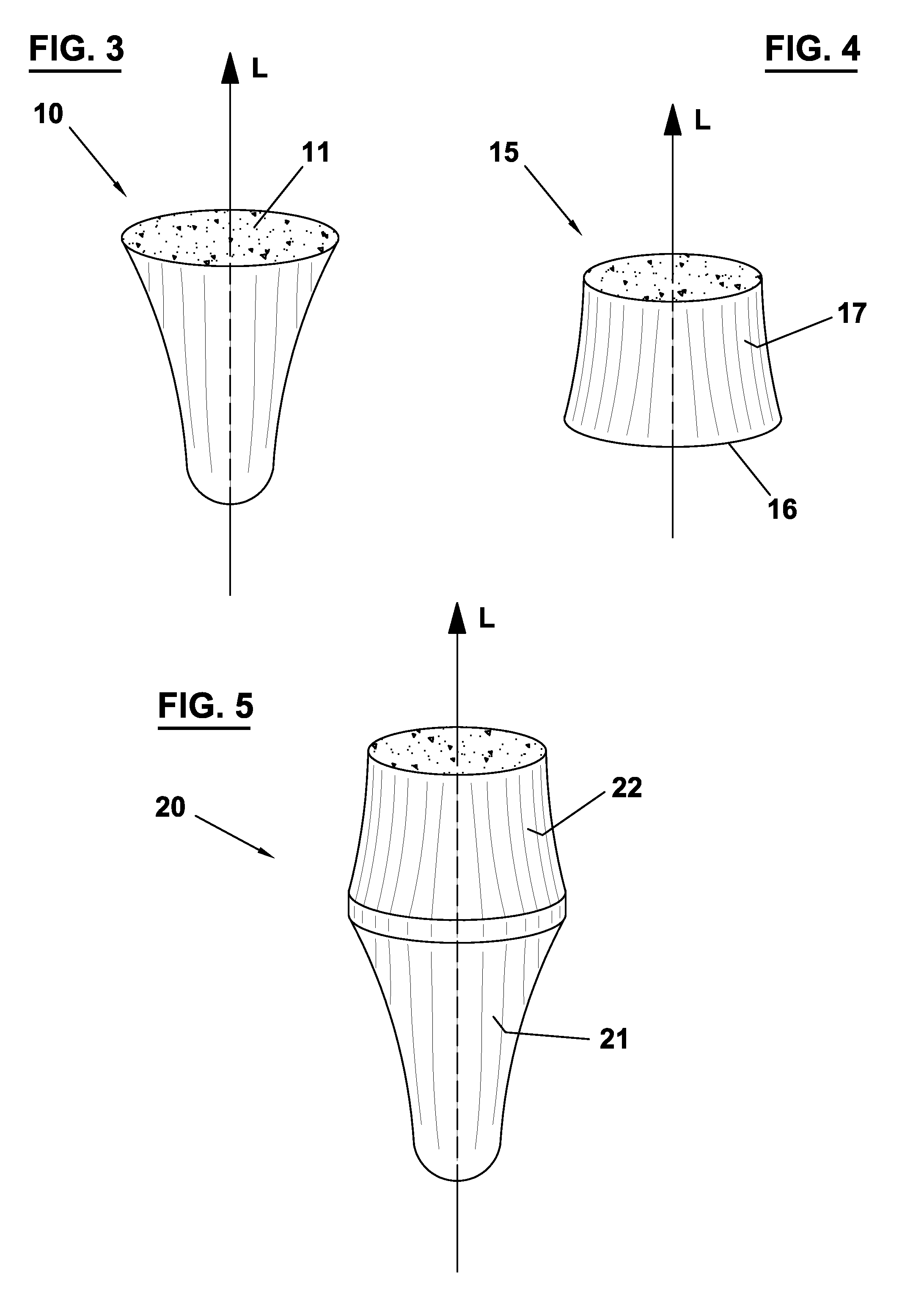 Dental implant