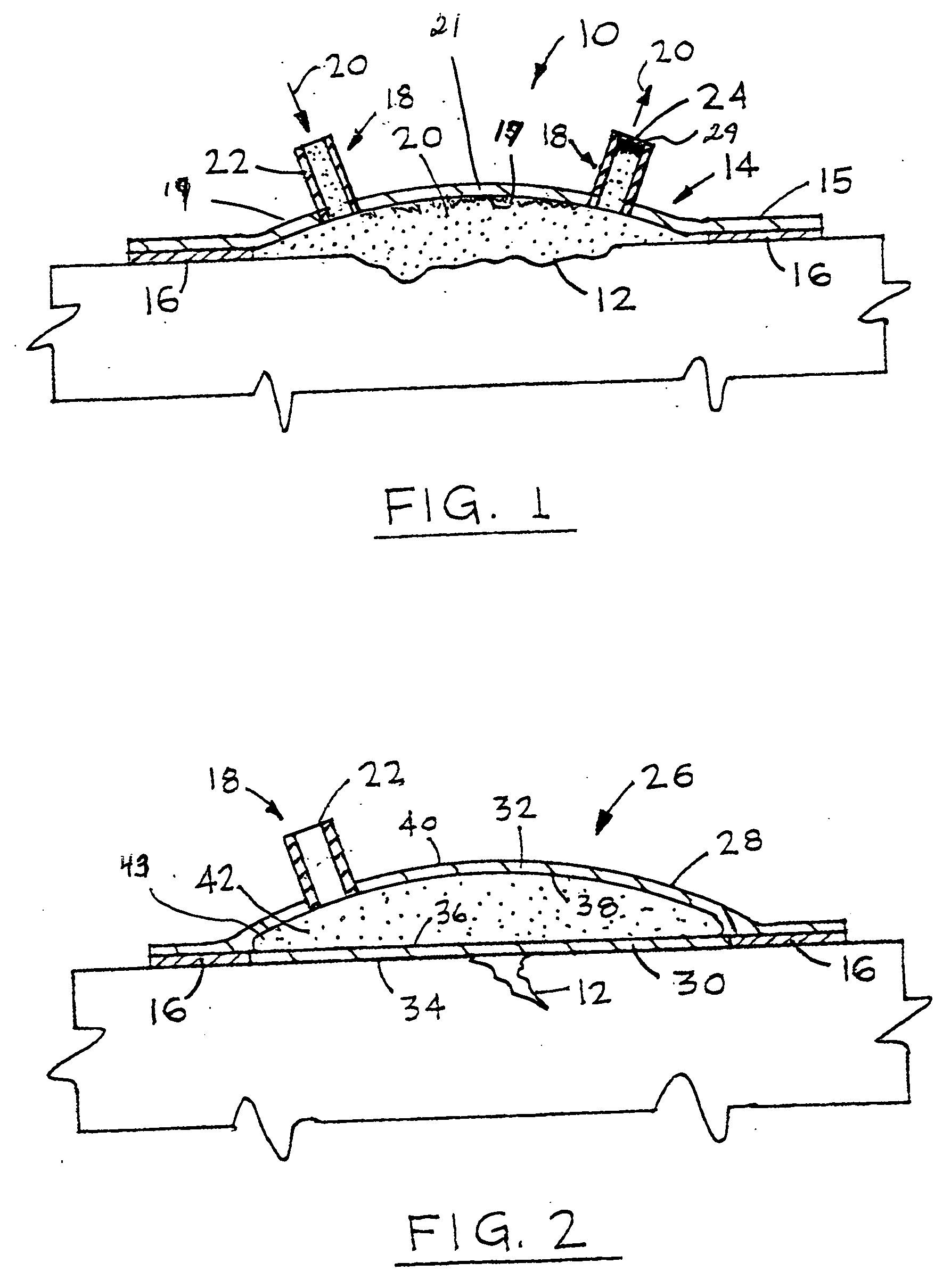 Wound alternative treatment system