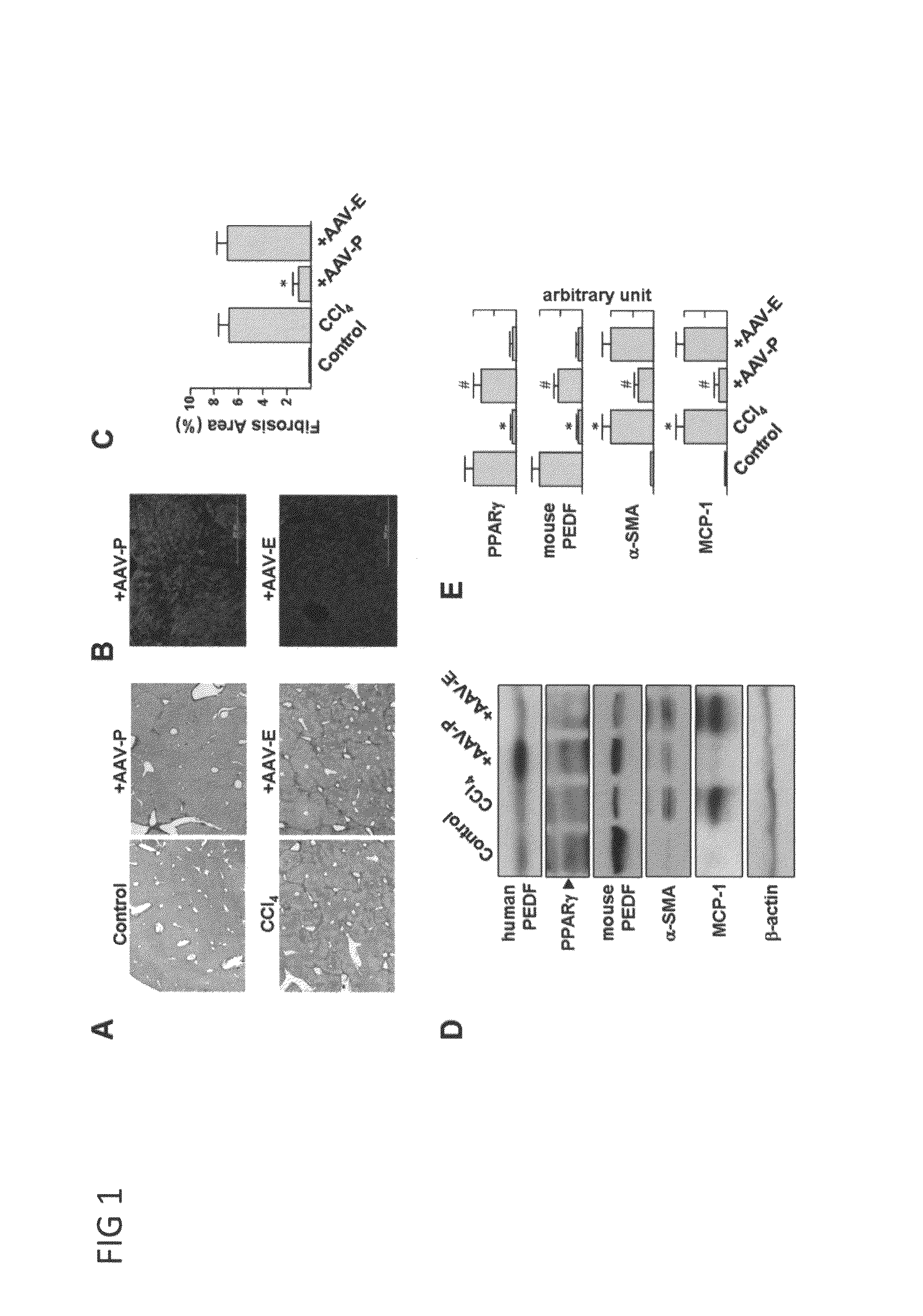 Use of PEDF-derived polypeptides for treating liver cirrhosis