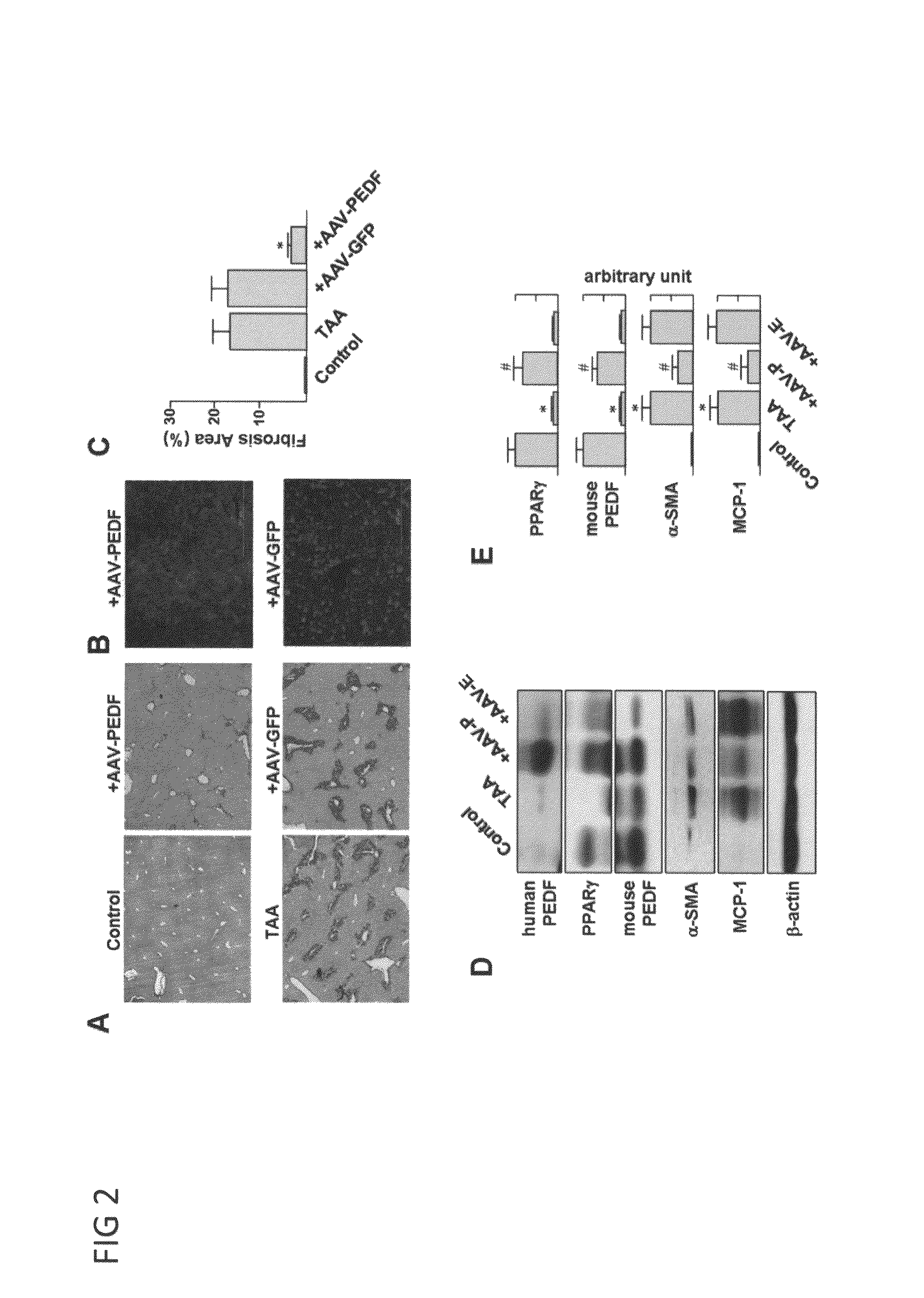 Use of PEDF-derived polypeptides for treating liver cirrhosis