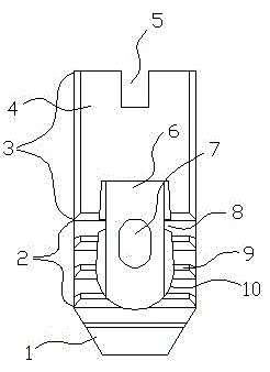 a vertebral body fusion