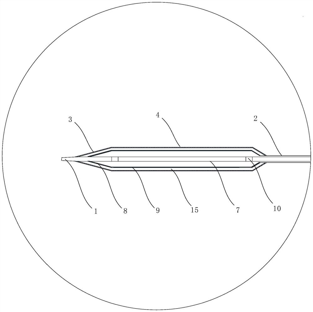 Drug-loaded double-layer spinous process balloon catheter