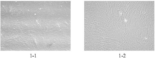 A kind of adipose mesenchymal stem cell osteogenic induction composition and its osteogenic induction method