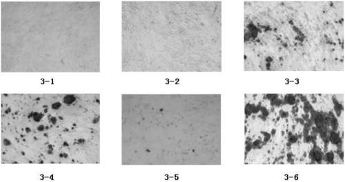 A kind of adipose mesenchymal stem cell osteogenic induction composition and its osteogenic induction method