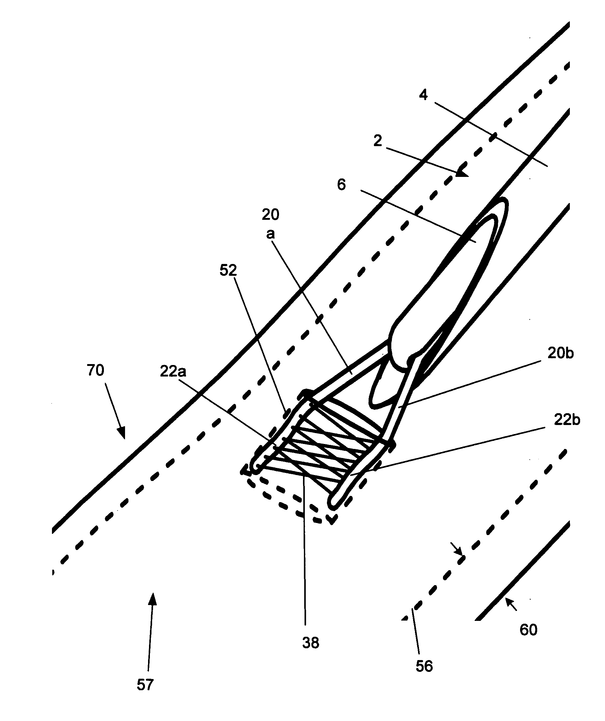 Biological tissue closure device and method