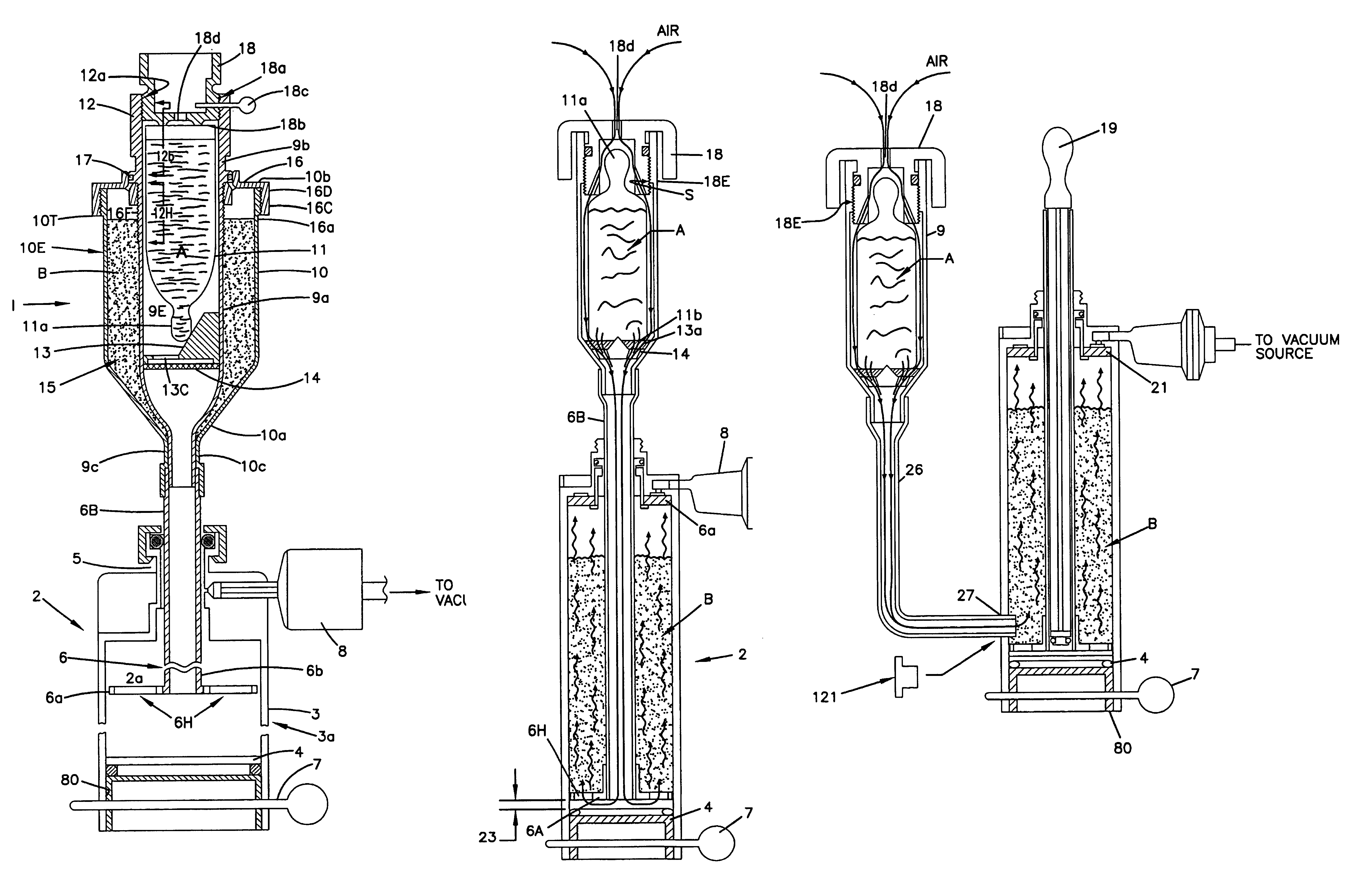 Method and device for feeding components for bone cement into a mixing vessel