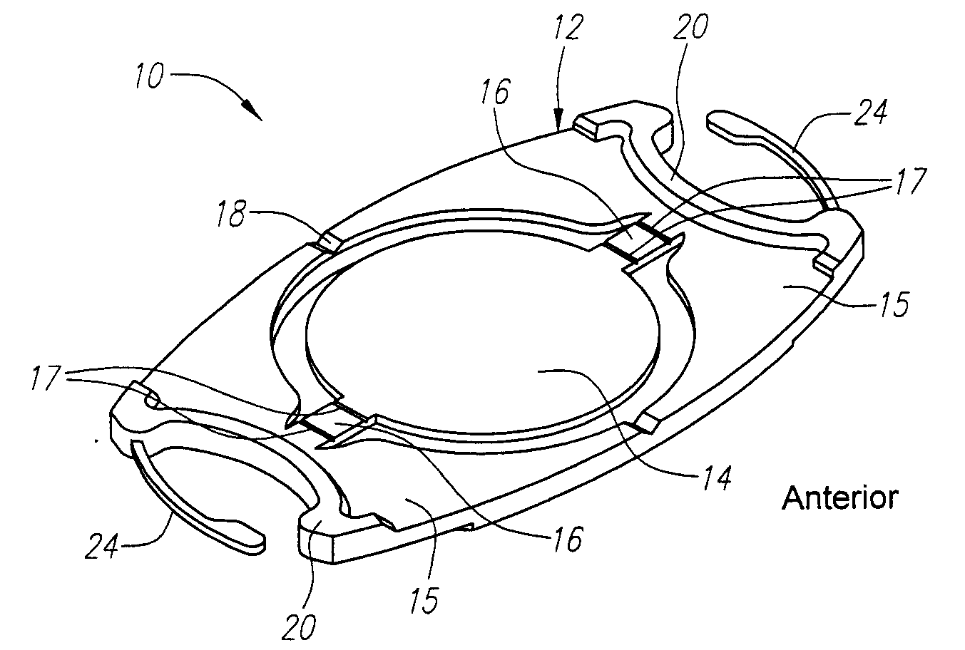 "W" Accommodating Intraocular Lens