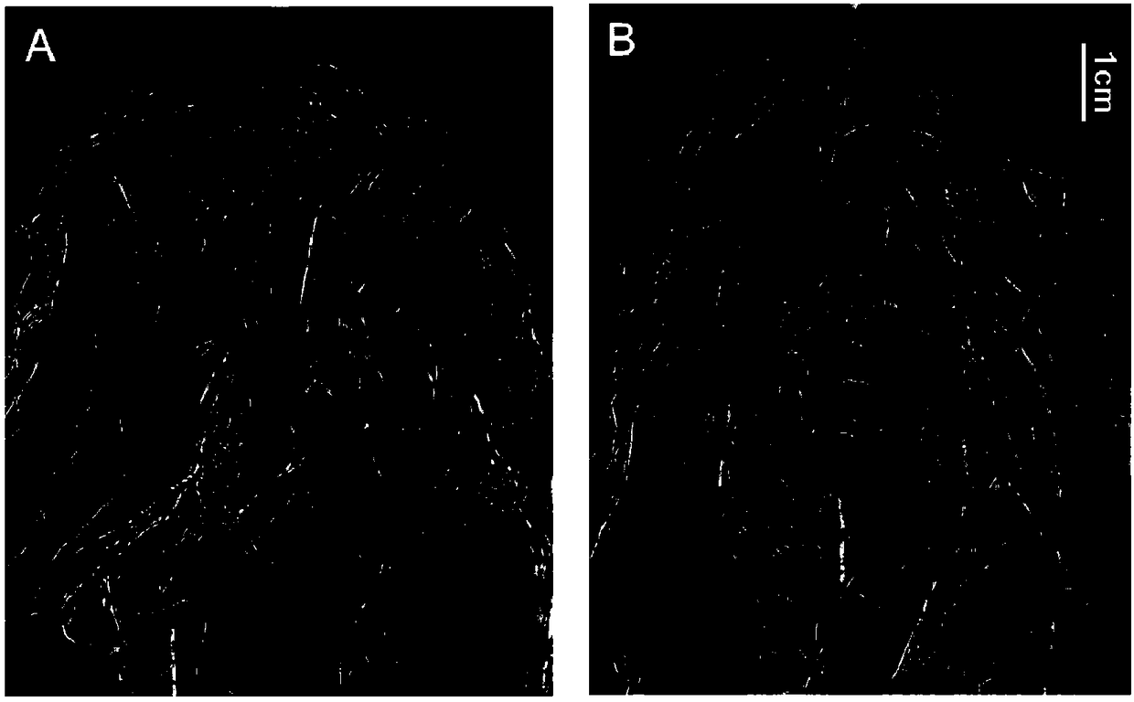 Gene for regulating number of nodules of nodule plants and application of gene to efficient nitrogen fixation aspect