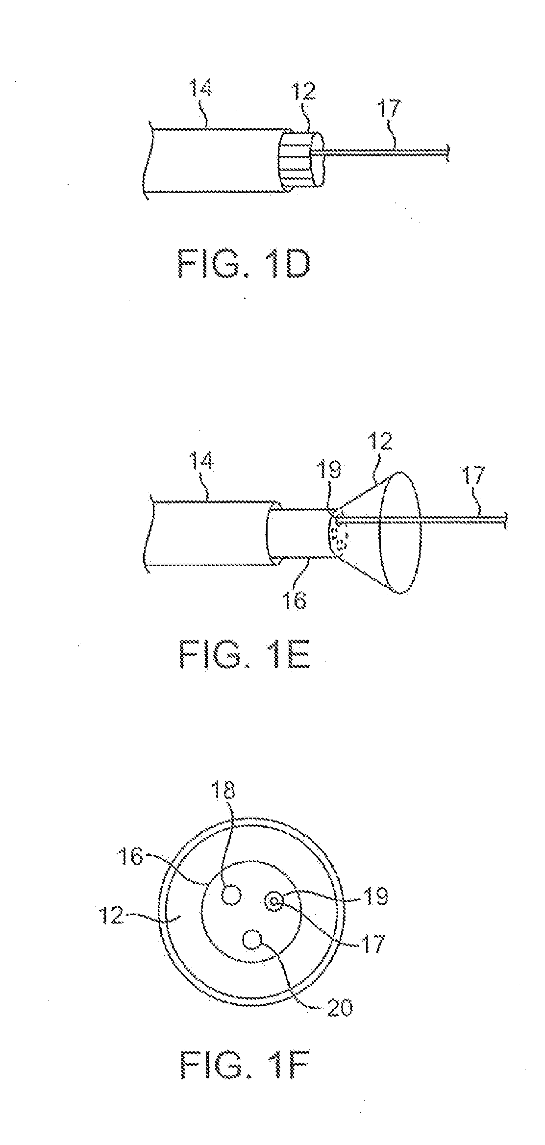 Tissue visualization device and method variations