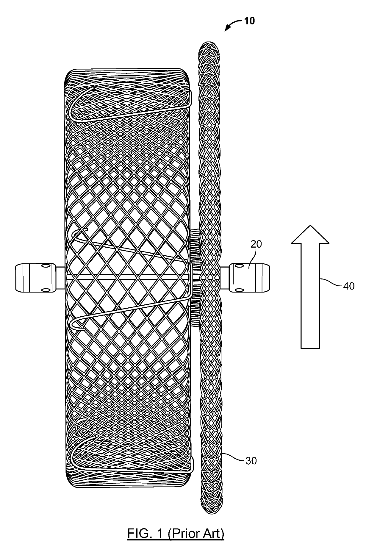 Percutaneous catheter directed intravascular occlusion devices with retractable stabilizing wires