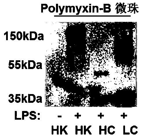 A lipopolysaccharide-binding protein polypeptide and its pharmaceutical use