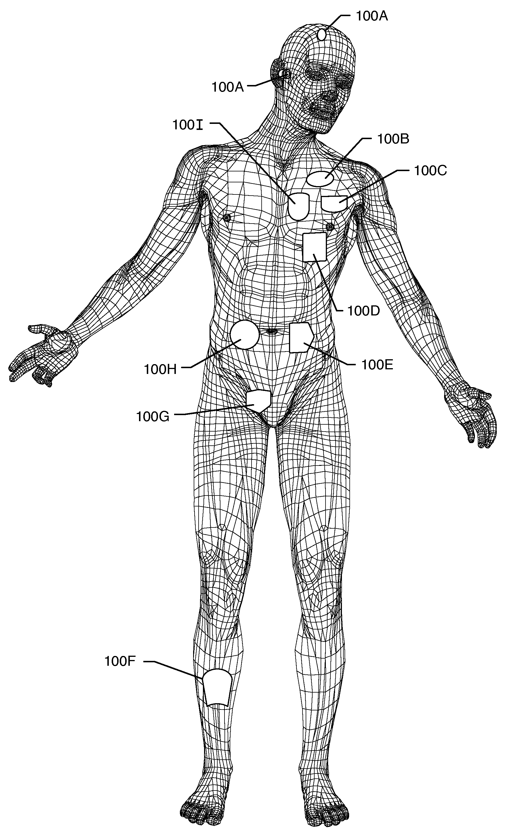 Dielectric fluid filled active implantable medical devices