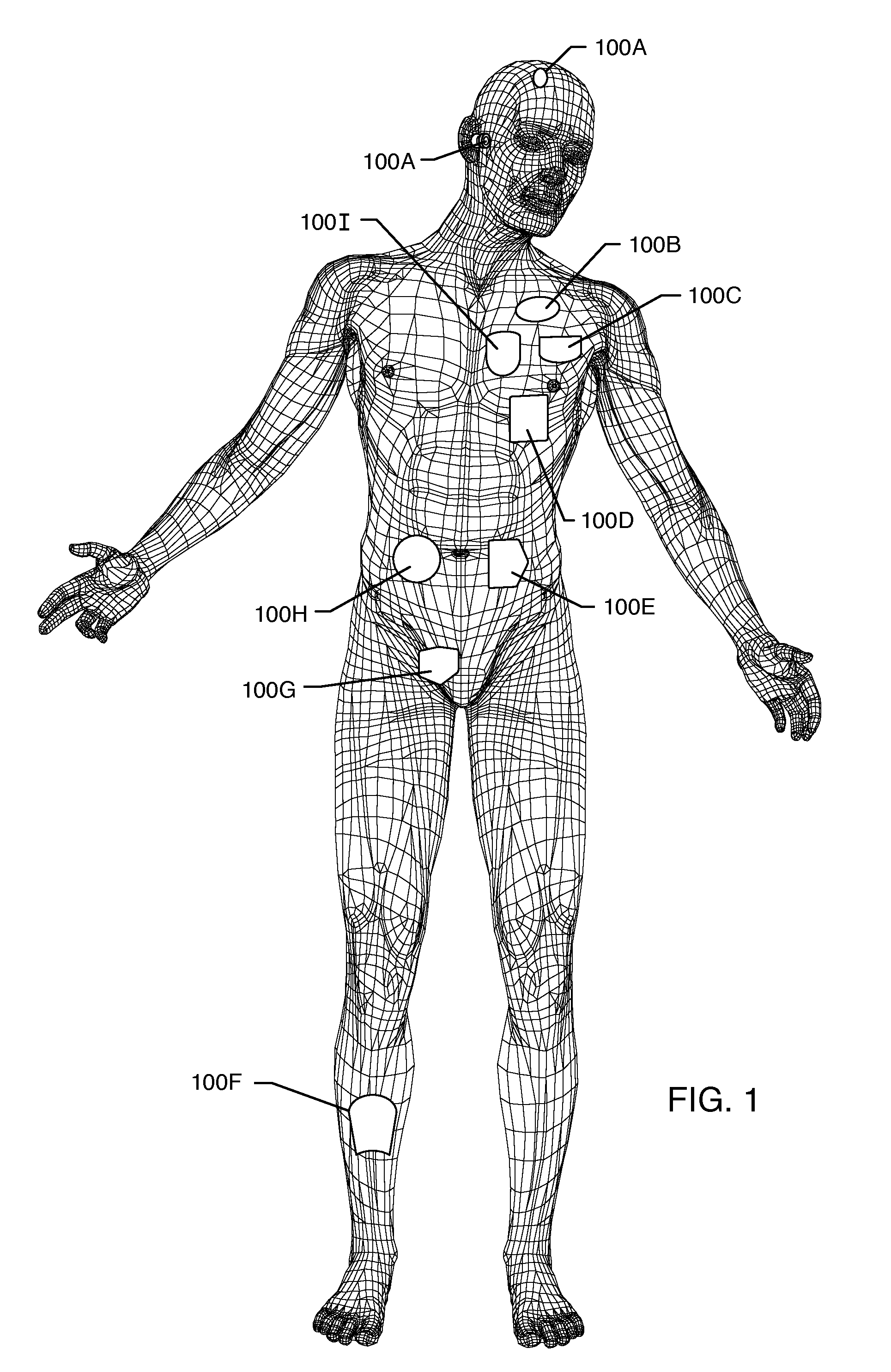 Dielectric fluid filled active implantable medical devices