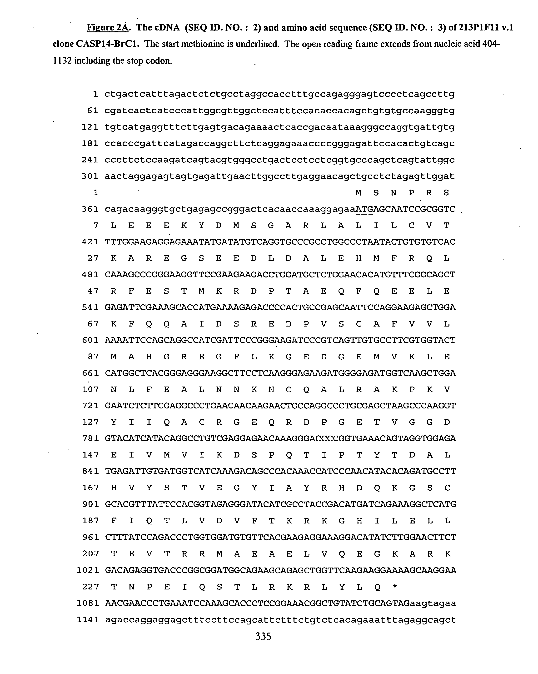 Nucleic acid and corresponding protein entitled 213P1F11 useful in treatment and detection of cancer