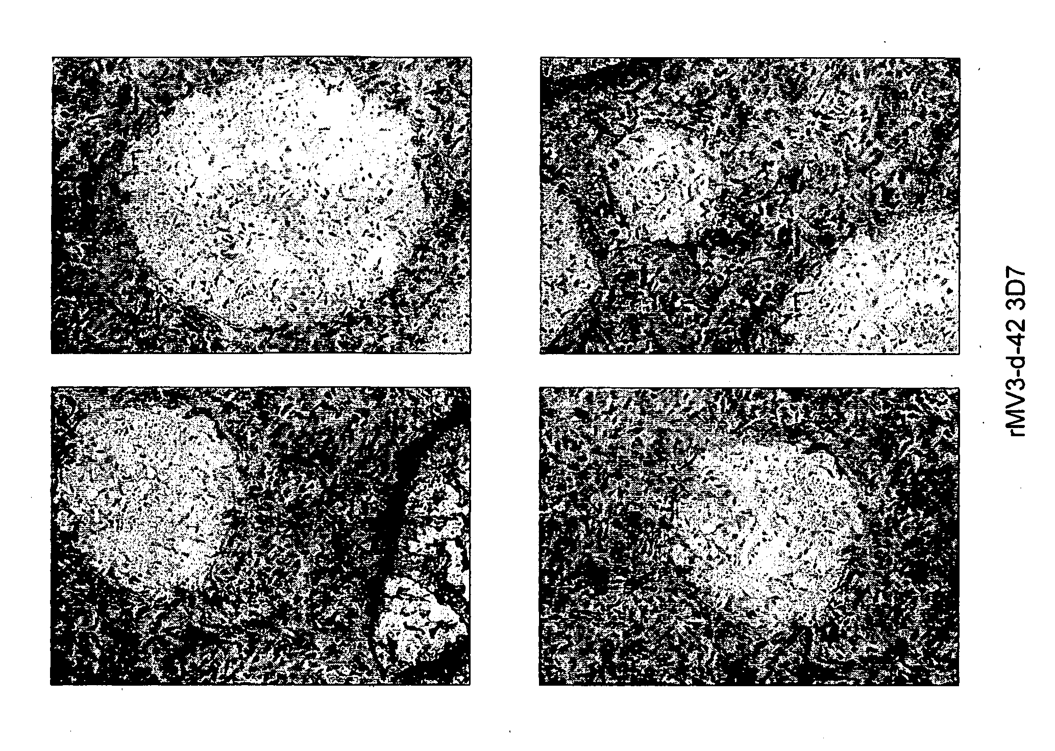 Combined measles-malaria vaccine