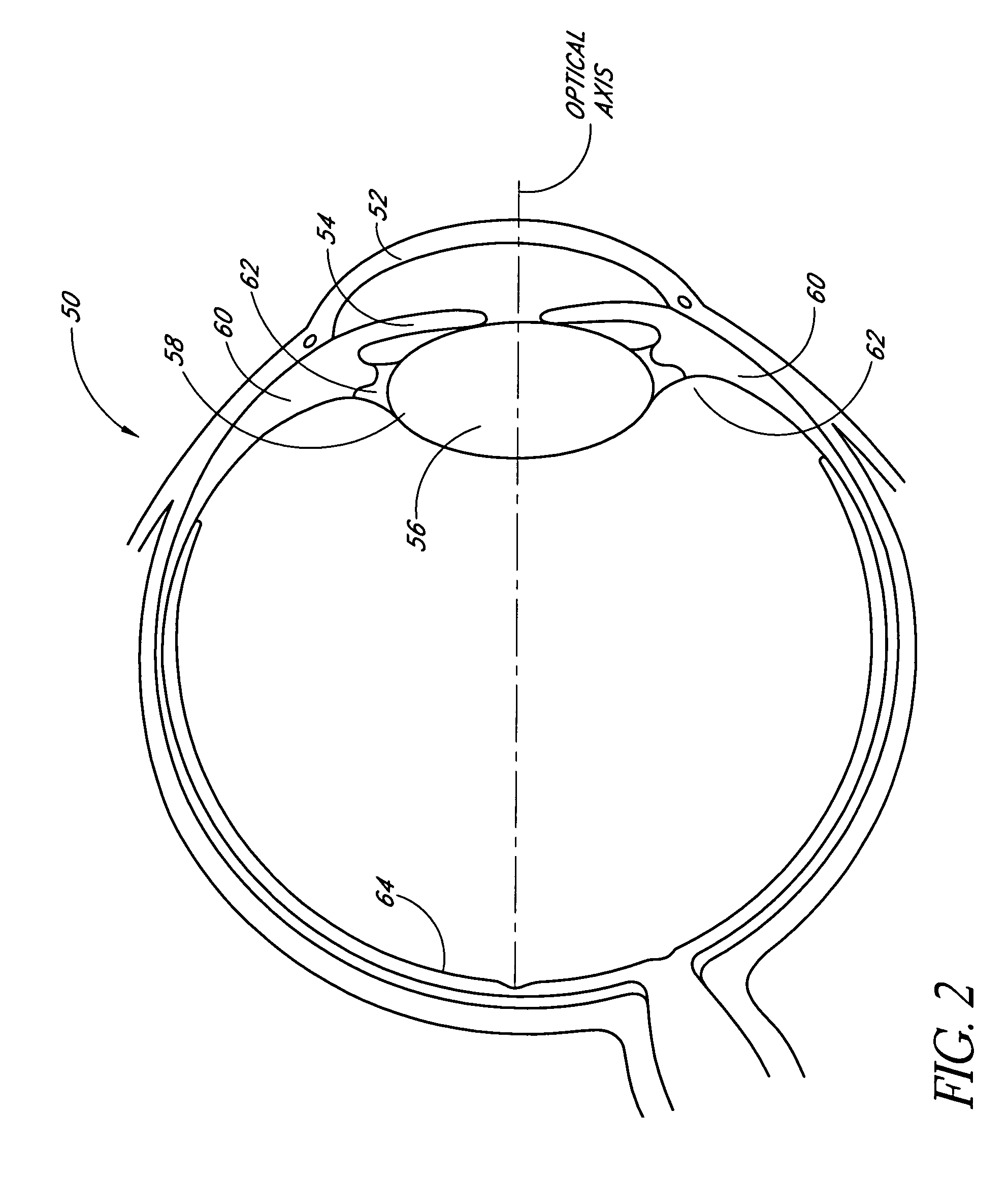 Accommodating intraocular lens system with aberration-enhanced performance