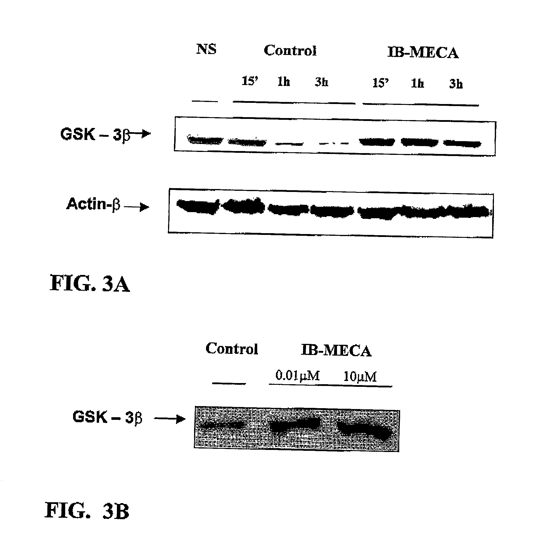 Modulation of GSK-3beta activity and its different uses