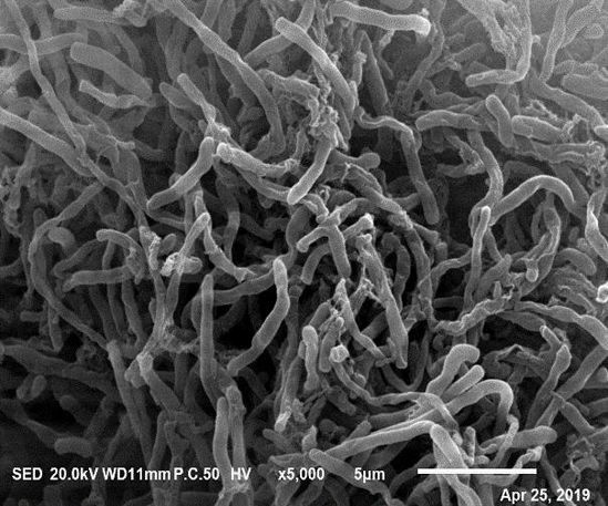 A kind of Streptomyces albicans x-18 and the method for producing ε-polylysine by using the bacterium