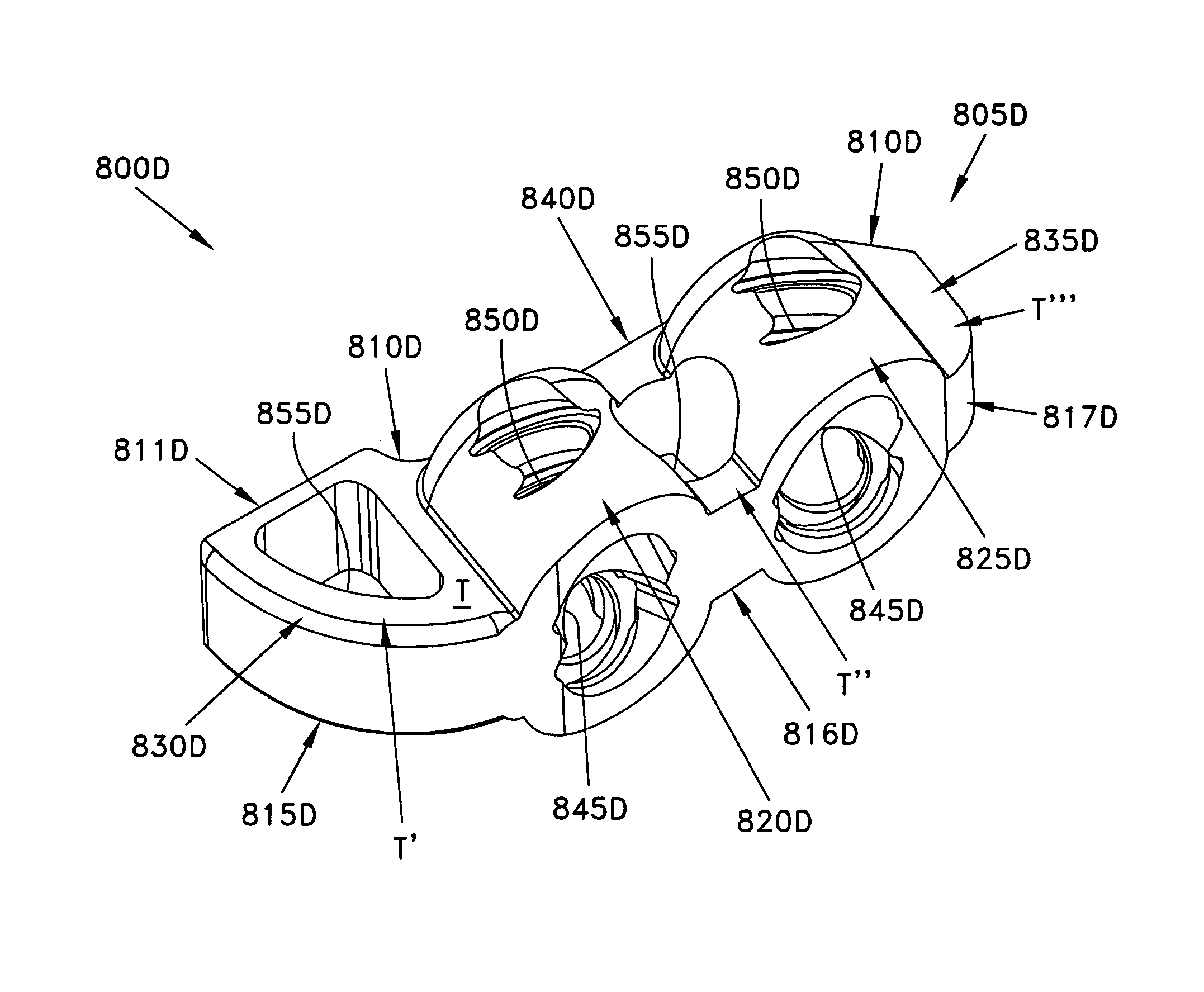 Method and apparatus for performing an open wedge, high tibial osteotomy