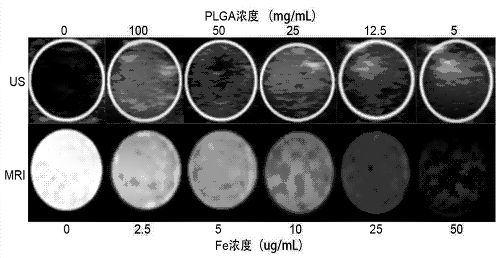 Multipurpose contrast agent applied to ultrasonography/magnetic resonance imaging (US/MRI) guidance synergistic high-intensity focused ultrasound ablation and preparation method for multipurpose contrast agent