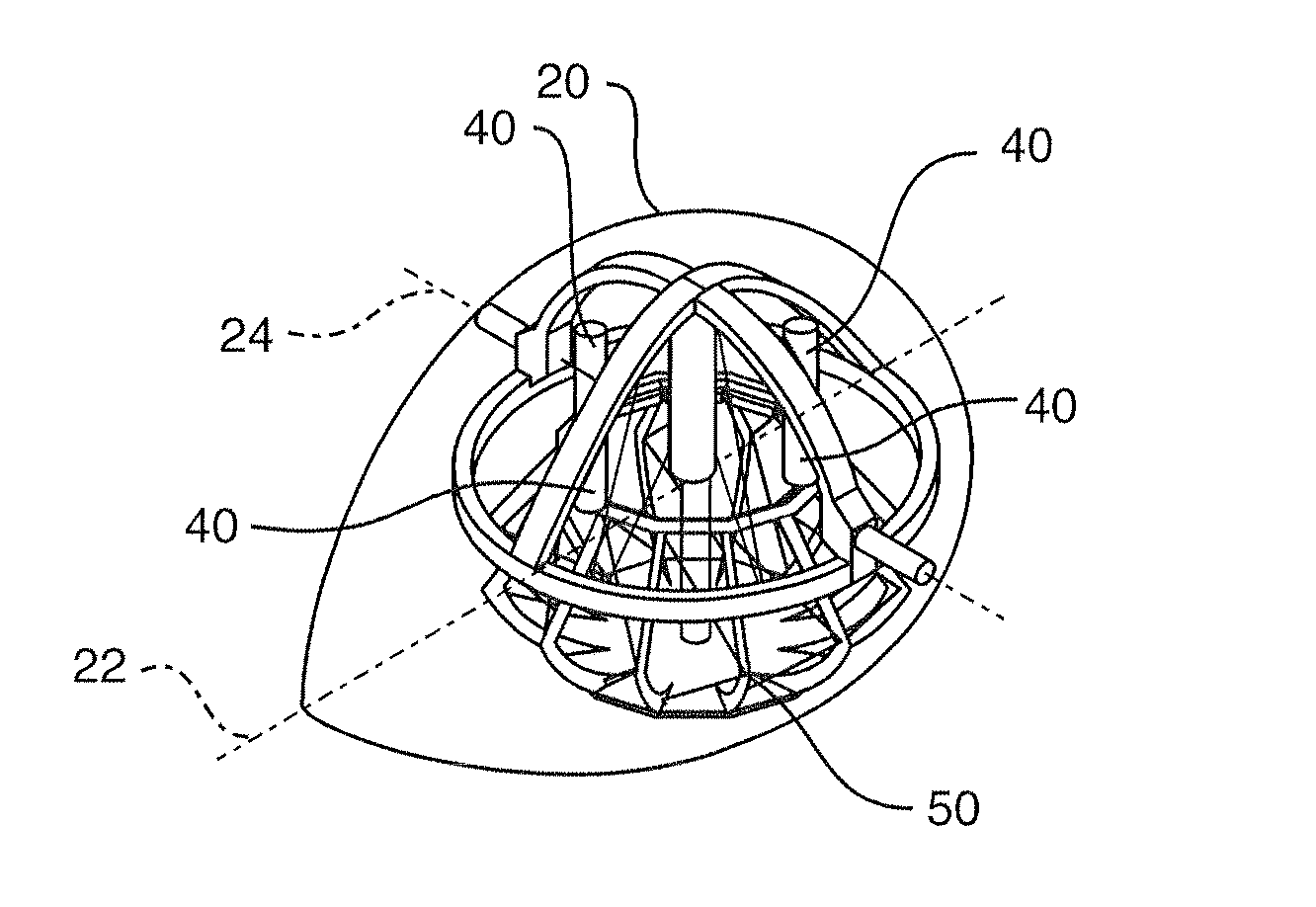 Stabilization system for sensors on moving platforms