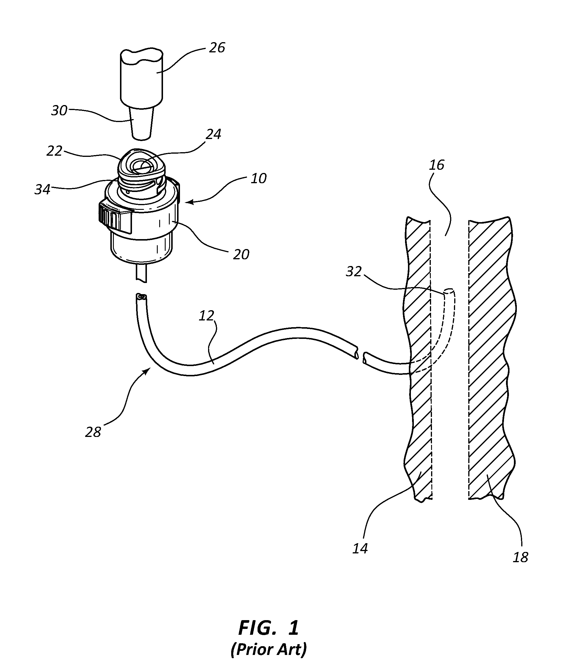 Retention feature for soft interface connection