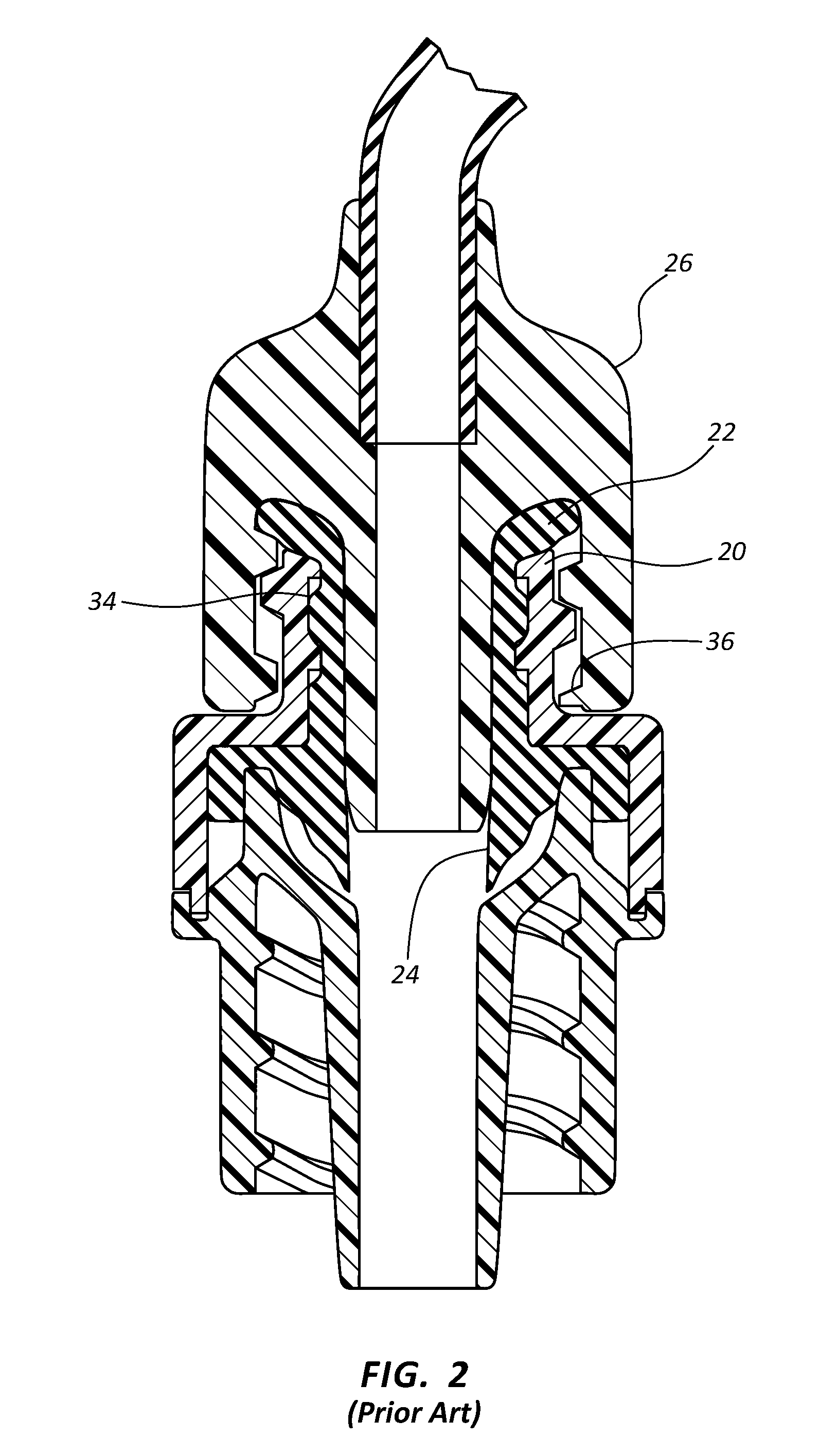 Retention feature for soft interface connection