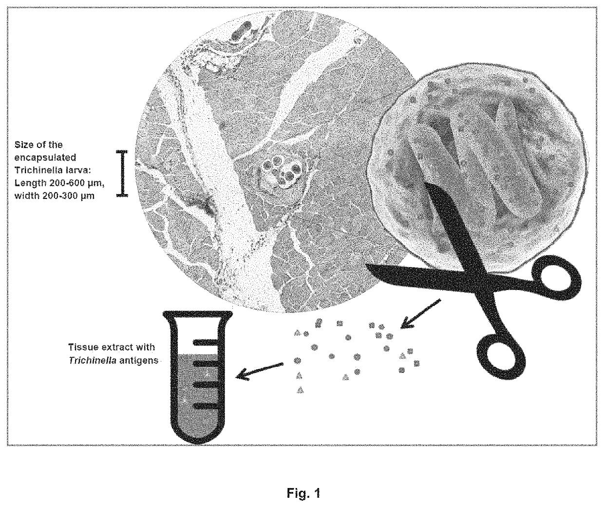 Antigen detection of <i>Trichinella</i>