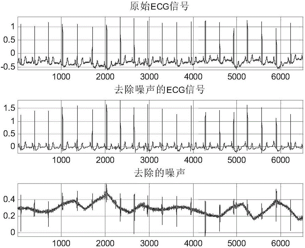 Automatic classification method, system and device of electrocardiosignal ST band