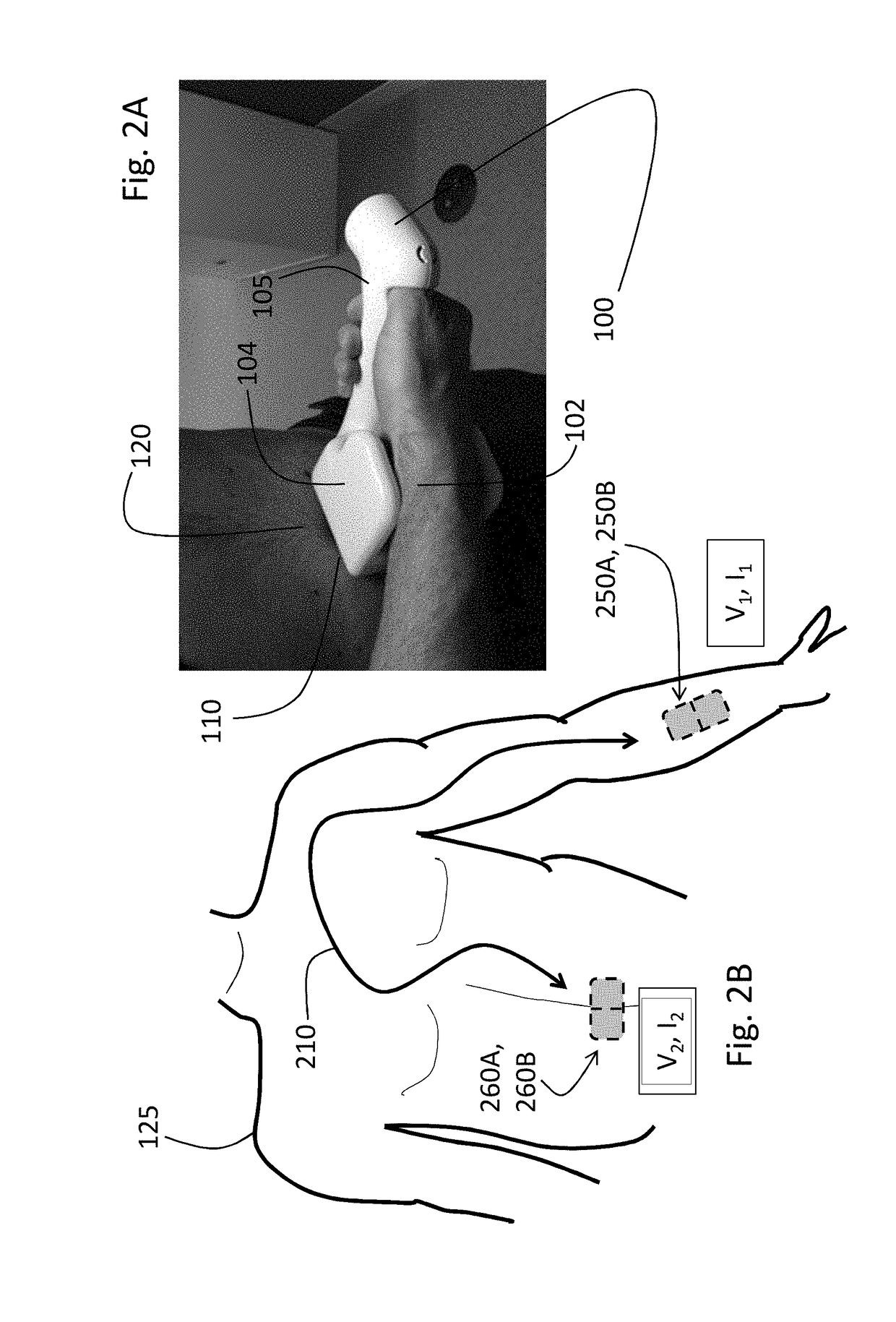 Handheld physiological sensor