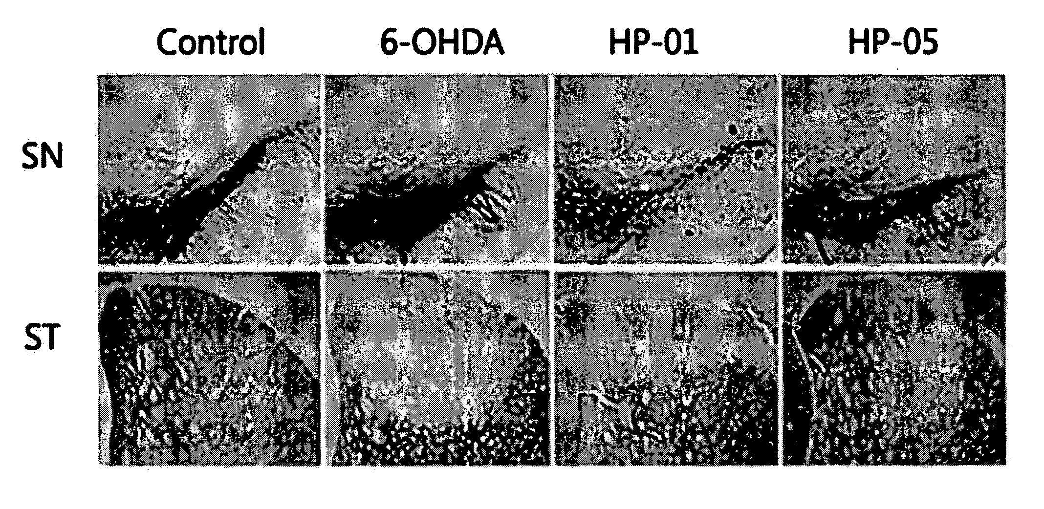 Composition comprising the purified extract of bee venom for preventing and treating degenerative brain disease