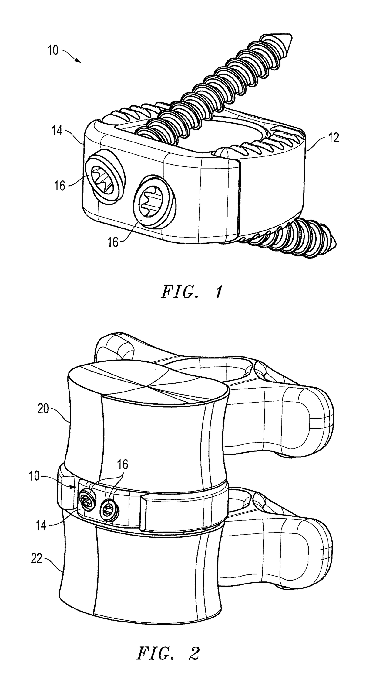 Interbody fusion device with lipped anterior plate and associated methods