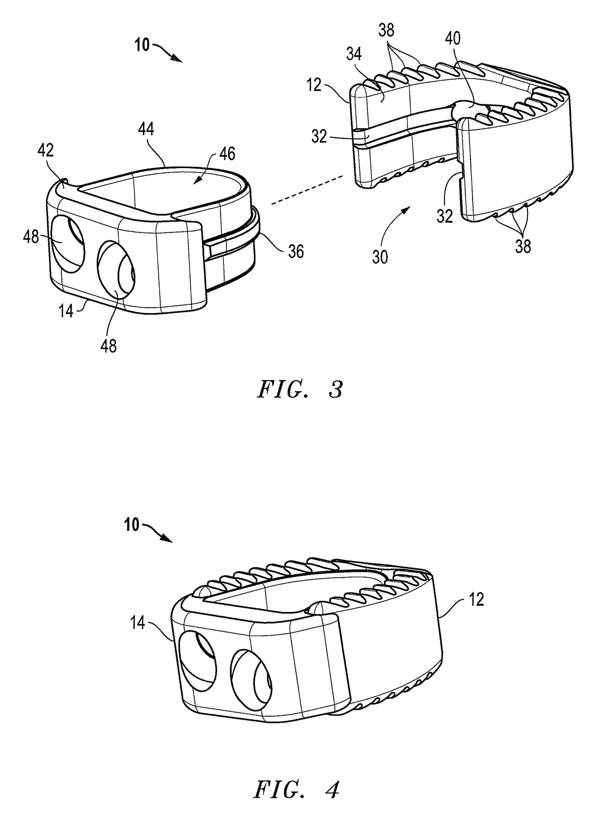 Interbody fusion device with lipped anterior plate and associated methods