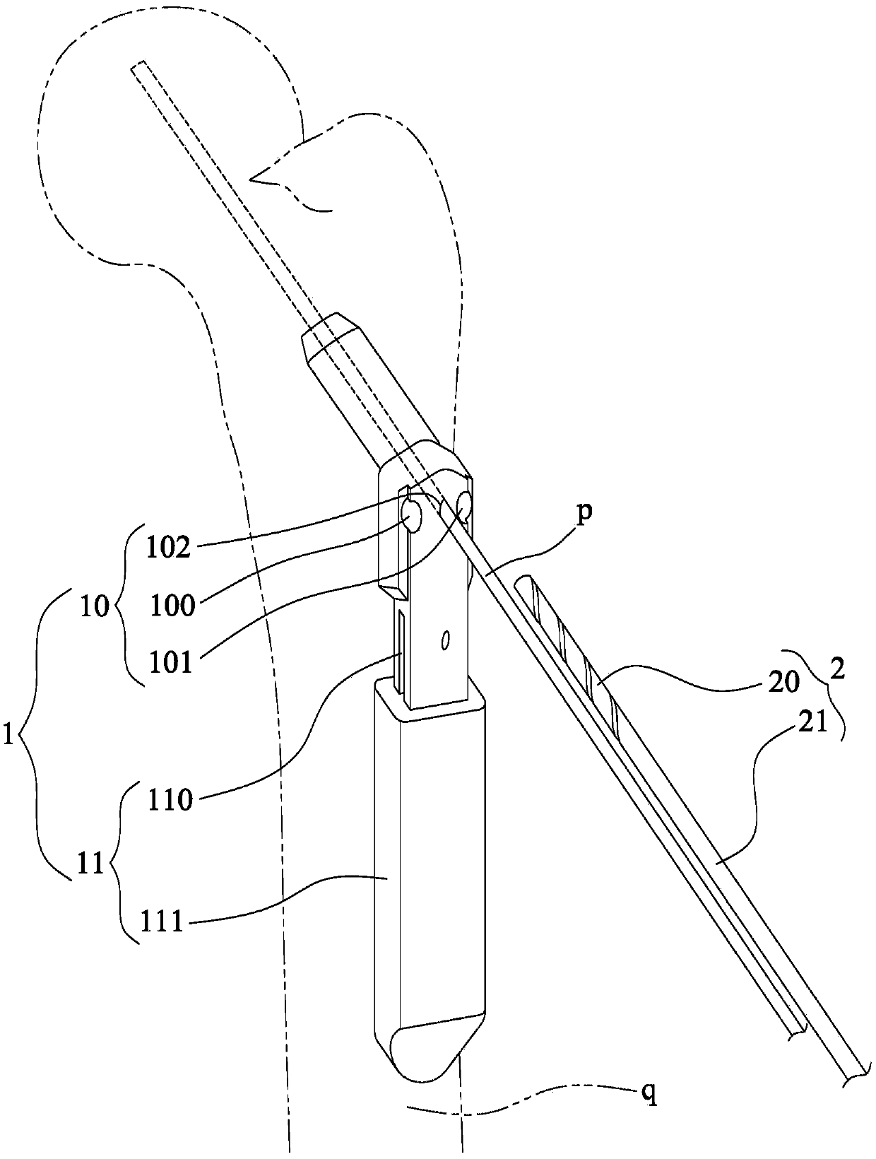 Proximal femoral fracture repair auxiliary combination device and auxiliary components thereof