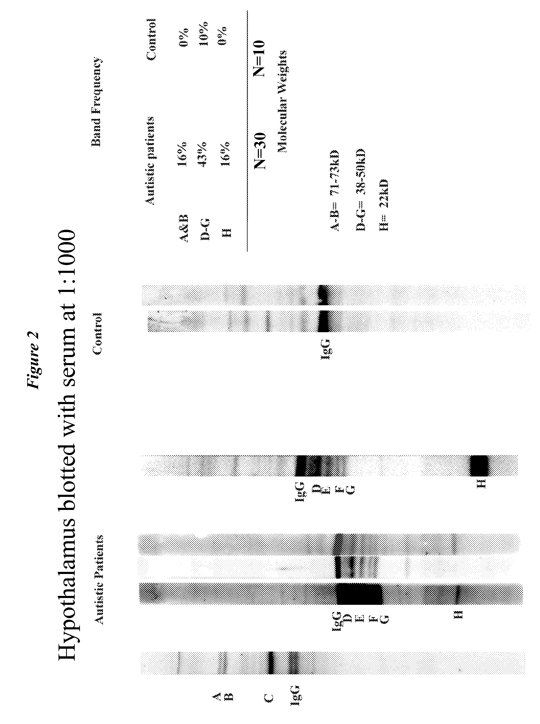 Diagnostic methods for the detection of risk of neurodevelopmental disorders