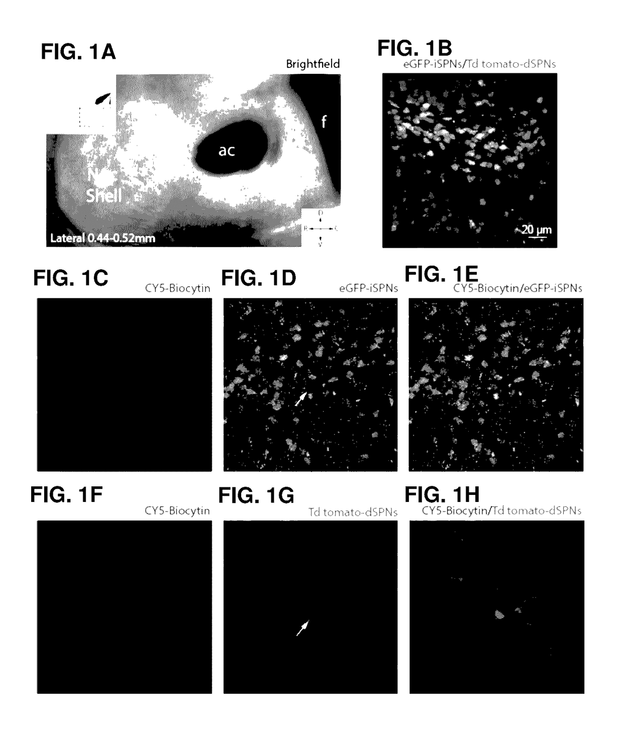 Methods and compositions for treating pain