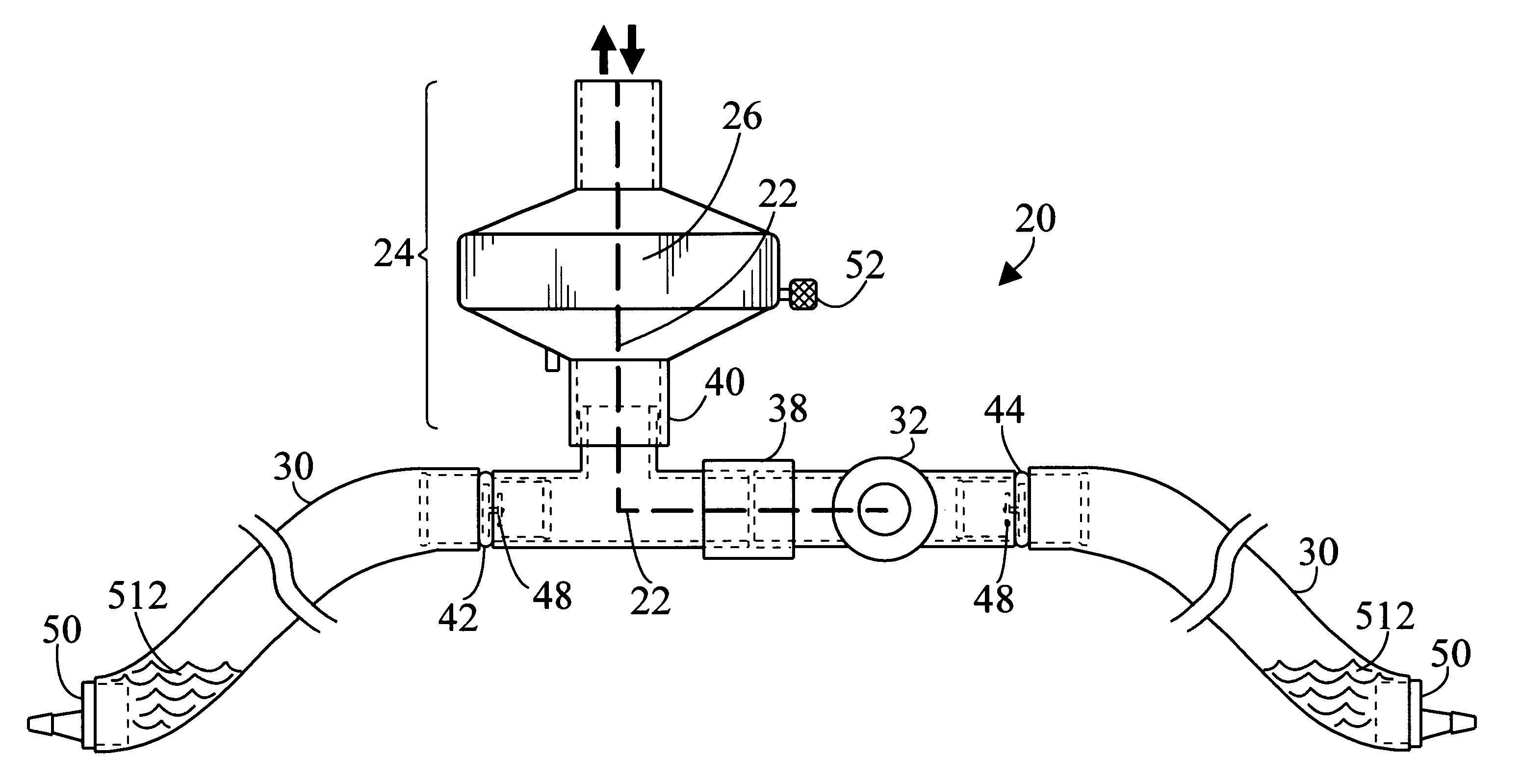 Method of breathing tracheally