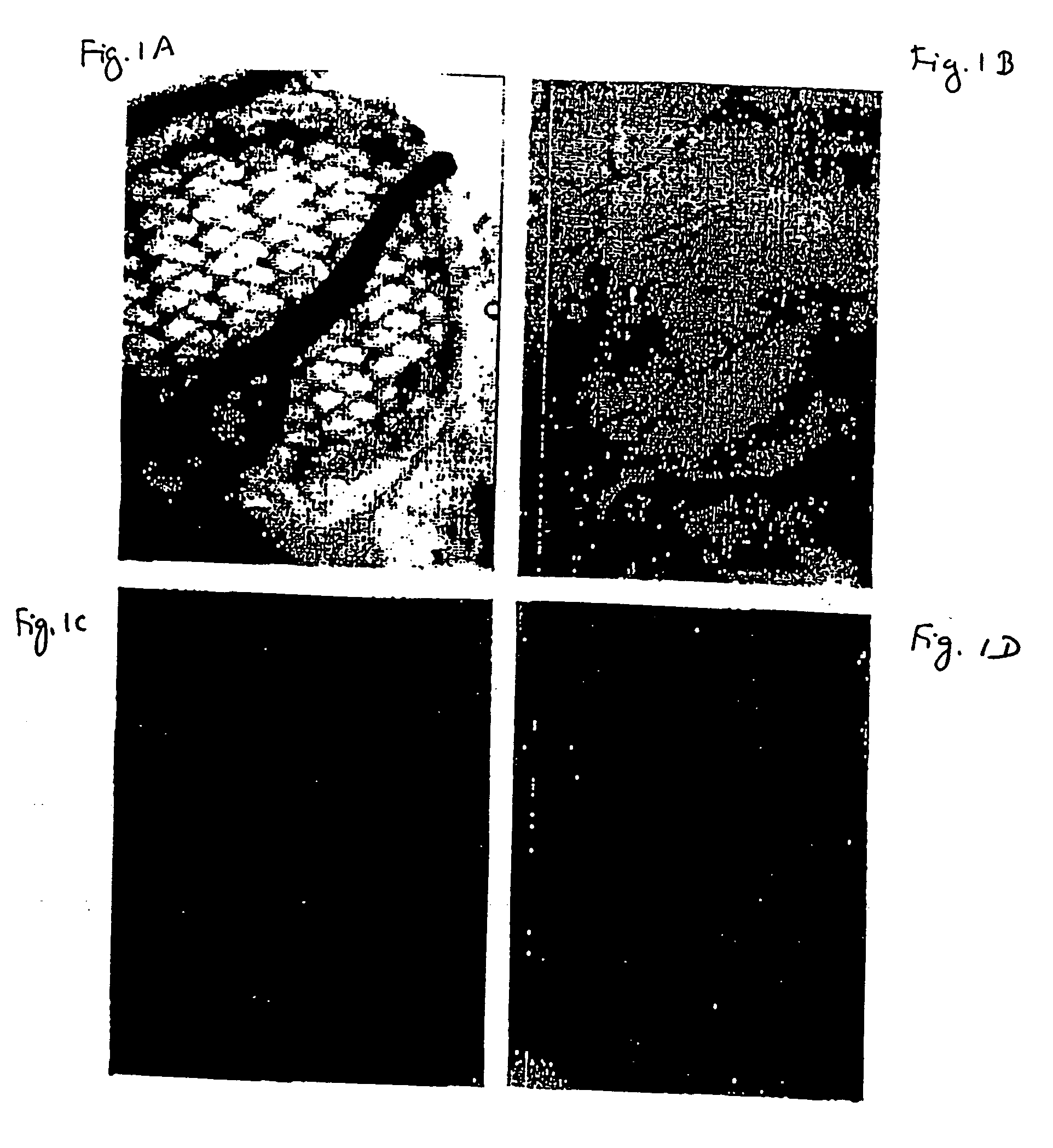 Methods for using a three-dimensional stromal tissue to promote angiogenesis