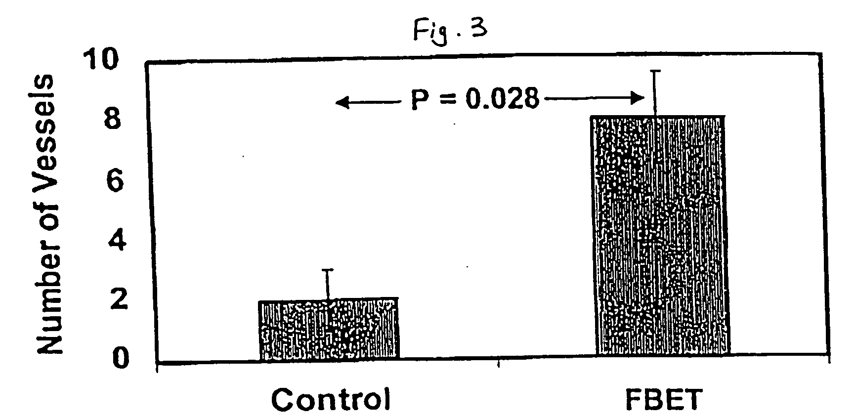 Methods for using a three-dimensional stromal tissue to promote angiogenesis